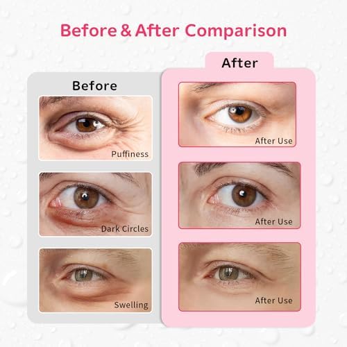 4PCS Gel Eye Ice Pack Set Reusable, Cold and Hot Compress for Eyes, Ice Pack for Eyes, Cooling Eye Pads for Eye Strain, Swelling, Redness, Dark Circles, Puffy Eyes, and Eye Recovery Surgery.