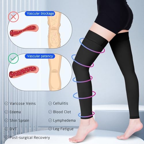 Compression Stockings for Women & Men, 15-20 mmHg Thigh High Compression socks, Medical Graduated Compression Support for Edema, Varicose Veins, Swelling