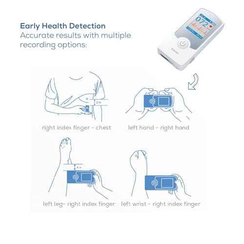Beurer Cardio Companion EKG Monitor - 3-Lead Portable ECG Machine, Detects Irregular Heart Rhythms, Fast Results in 30 Seconds, Bluetooth with App, Rechargeable Battery, FSA/HSA Eligible, ME75