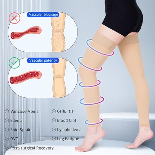 Compression Stockings for Women & Men, 15-20 mmHg Thigh High Compression socks, Medical Graduated Compression Support for Edema, Varicose Veins, Swelling