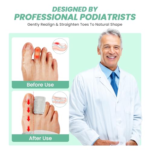 Hammer Toe Straightener Corrector for Women & Men, Non-Slip Toe Splint with Aluminum Plate for Hammer, Curled, Crooked Toes, Pain Relief, Broken Support (1 Compression Foot Wrap & 1 Strap, Gray)