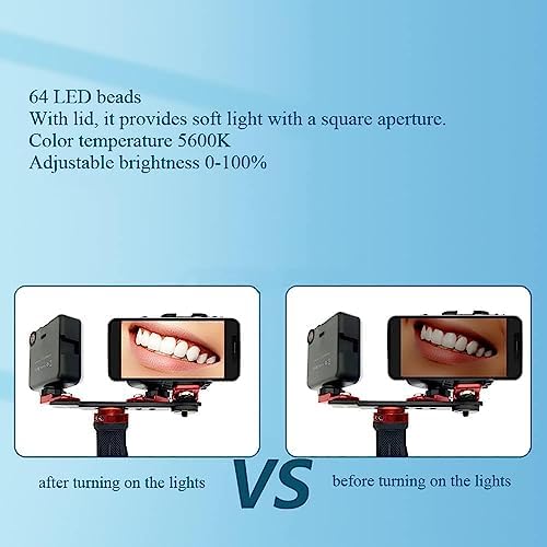 TsoLay Mini Rechargeable Dental Photography Aid, 5600K Oral Cell Phone Fill Light with 64 LED Beads, 360 Degree Rotation and Brightness Stepless Adjustment, for Oral Photo Assistance