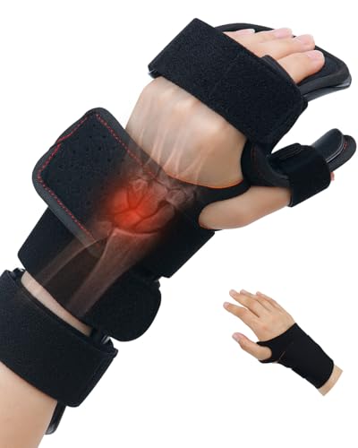 Stroke Resting Hand Splint & Wrist Brace Support Bundle - Prevent Flexion Contractures, Night Immobilizer Wrist Finger Brace with Finger Separator for Stroke Recovery, Arthritis, Tendinitis