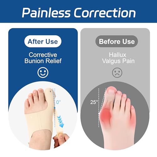 RANDY SUN Bunion Corrector for Big Toe, Toe Corrector for Women & Men, Adjustable Toe Separator Splint for Hallux Valgus Relief - Comfortable & Breathable for Day/Night Support, Large