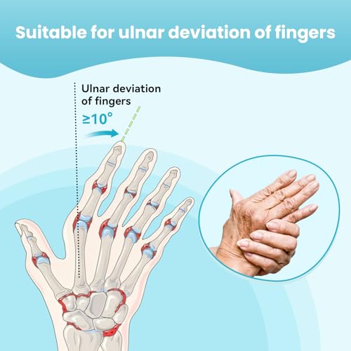 DrFinger Finger Ulnar Deviation Splint Brace, Finger Joint Deviation Orthopedic Corrector With Metal Bracket-Beige-Right(L/XL)