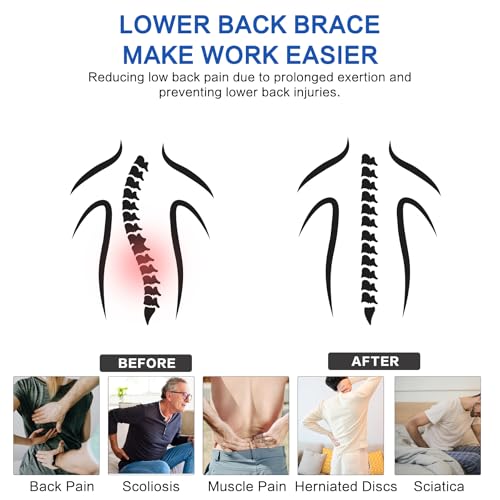 Back Brace Support Belt For Men & Women, Lumbar Support Belt Relief for Upper and Lower Back Pain , Sedentariness ,Sciatica，Scoliosis and Herniated Disc -Adjustable Breathable Back Brace Suitable For Home, Fitness, Driving, Work,Travel-Black(Medium)