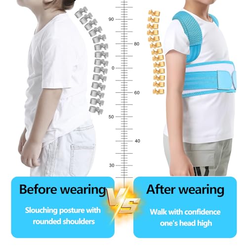 Posture Corrector for Kids,Adjustable Children Posture Corrector for Boys/Girls,Breathable Back Support Belt with Spine Lumbar Shoulder Braces for Hunchback，Spine Corrector (Blue, Large)