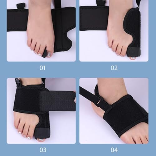 Recovist Bunion Brace, 2025 New Recovist Bunion Brace For Women, Adjustable Orthopedic Splint For Hallux Valgus Correction, Advanced Alignment Technology, Just 20 Minutes A Day (Left)