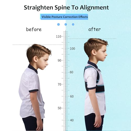 Posture Corrector For Kids - Back Brace Posture Corrector - Spine Corrector, Adjustable Upper Back Posture Brace, Prvent Children Humpback (Blue, M)