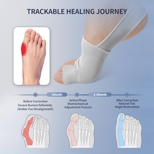 2PCS Bunion Corrector for Women & Men Big Toe, Bunion Relief Toe Straightener Bunion Splint Anti-Slip Heel Strap Comfortable Breathable for Day and Night Wear Gray L