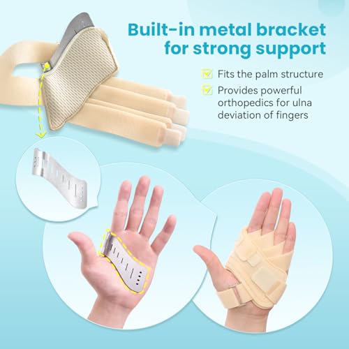 DrFinger Finger Ulnar Deviation Splint Brace, Finger Joint Deviation Orthopedic Corrector With Metal Bracket-Beige-Right(L/XL)