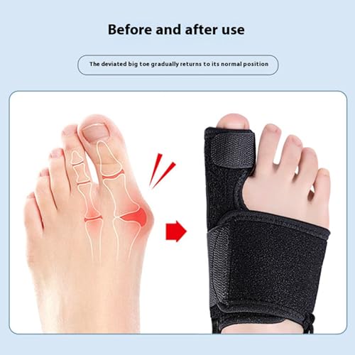 Recovist Bunion Brace, 2025 New Recovist Bunion Brace For Women, Adjustable Orthopedic Splint For Hallux Valgus Correction, Advanced Alignment Technology, Just 20 Minutes A Day (Left)
