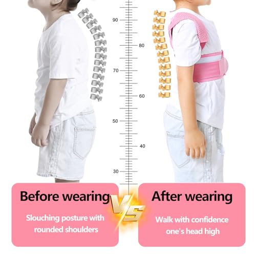 Posture Corrector for Kids,Adjustable Children Posture Corrector for Boys/Girls,Breathable Back Support Belt with Spine Lumbar Shoulder Braces for Hunchback，Spine Corrector (Pink, Large)