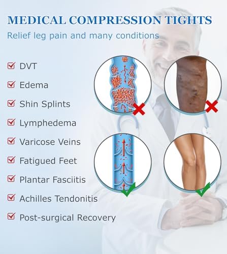 MGANG Medical Compression Pantyhose for Women & Men, 15-20mmHg Graduated Compression Support Tights, Open Toe, Opaque Waist High Compression Stockings for Edema, Varicose Veins, Flight, DVT, Beige L