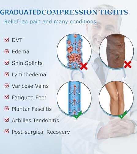 MGANG Medical Compression Pantyhose for Women & Men, 15-20mmHg Graduated Compression Support Tights, Open Toe, Opaque Waist High Compression Stockings for Edema, Varicose Veins, Flight, DVT, Beige XL
