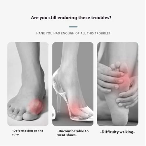 Recovist Bunion Brace, 2025 New Recovist Bunion Brace For Women, Adjustable Orthopedic Splint For Hallux Valgus Correction, Advanced Alignment Technology, Just 20 Minutes A Day (Left)