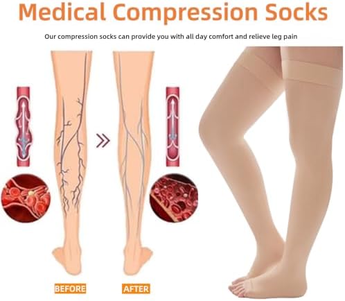 20-30 mmHg Compression Stockings for Women and Men, Open Toe Thigh High Compression Socks, Best Support for Varicose Veins, Edema, DVT