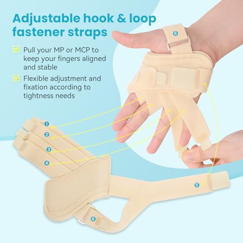 DrFinger Finger Ulnar Deviation Splint Brace, Finger Joint Deviation Orthopedic Corrector With Metal Bracket-Beige-Right(L/XL)