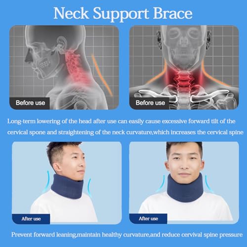 Neck Braces for Neck Pain and Support High-Density Comfort Cervical Collar for Vertebrae Stable and Aligned, Relieve Injury Spine Pressure – Neck Brace for Women & Men Sleeping, Working, Posture (Blue, Small)