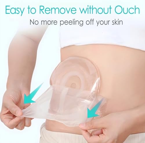 9" x 9" Ostomy Shower Cover [Pack of 25], Ostomy Bag Shower Protector Stoma Shower Guard Colostomy Shower Shields Waterproof Bandage for Women Men Showering