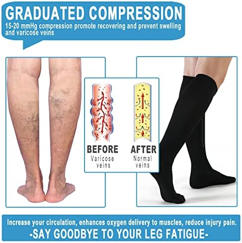 2 Pairs Medical Zipper Compression Socks 15-20mmHg for Women&Men, Knee High Compression Stockings