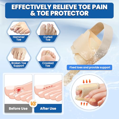 Hammer Toe Corrector for Women & Men - 1 Pcs Adjustable Toe Straightener for Curled Toes, Broken Support, Bunion Pain Relief - Includes 1 Compression Wrap, 1 Toe Splint & 1 Heel Strap (Beige)