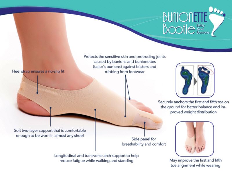 BunionETTE Bootie Tailor Bunion Corrector for Women & Men, Toe Spreader for Tailor Bunion, Bunionette Corrector, Bunionette Relief Socks, Bunionette Protector, Bunionette Spacer Splint - Medium, Left