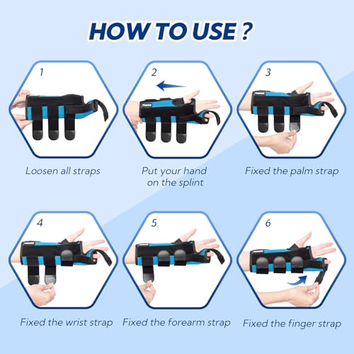 Boxer Fracture Splint, Ulnar Gutter Splint Right Hand, the 4th and 5th Metacarpal Finger Splint Hand Brace, Boxer Orthosis Hand & Wrist Brace for Women & Men, Left, M