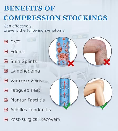 MGANG Medical 20-30 mmHg Compression Stockings for Women & Men, Pair, Thigh High Graduated Compression Socks, Closed Toe, Opaque, Support for Varicose Veins, Edema, DVT, Swelling, Flight, Beige M