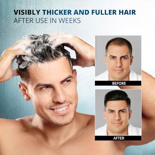 Root Activator Shampoo for Men: Made In USA - Hair Growth Shampoo for Hair Loss and Thinning Hair - Hair Loss RegrowthTreatments for Women Men (Refreshing Scent)