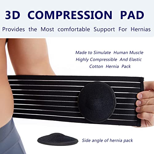 Umbilical Hernia Belt for Men and Women - Abdominal Support Binder with Compression Pad - Navel Ventral Epigastric Incisional and Belly Button Hernias Surgery Prevention Aid