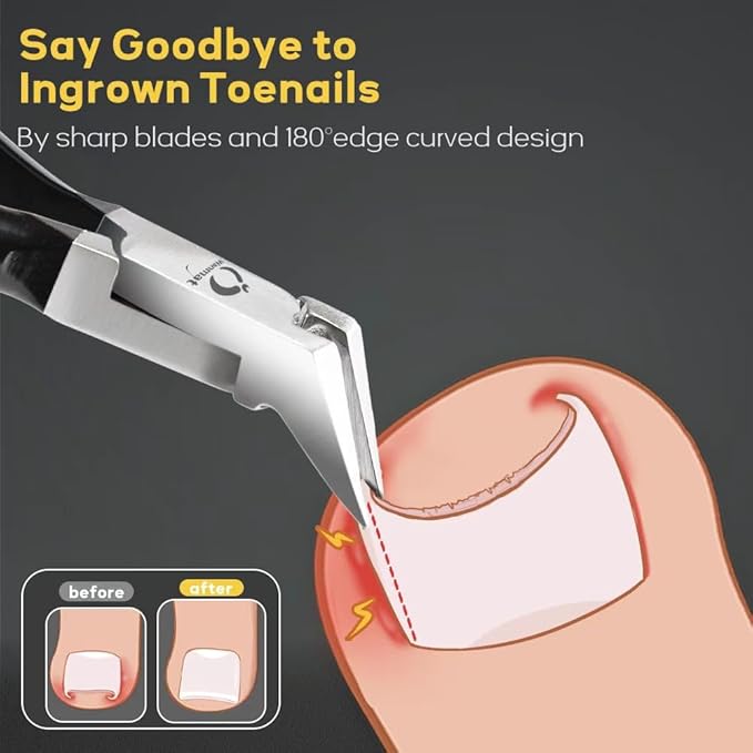 5 in 1 Professional Toenail Clippers for Thinck & Ingrown Nails, Upgraded Podiatrist Toe Nail Clippers for Men, Sharp Blade Nail Cutter Set, Wanmat