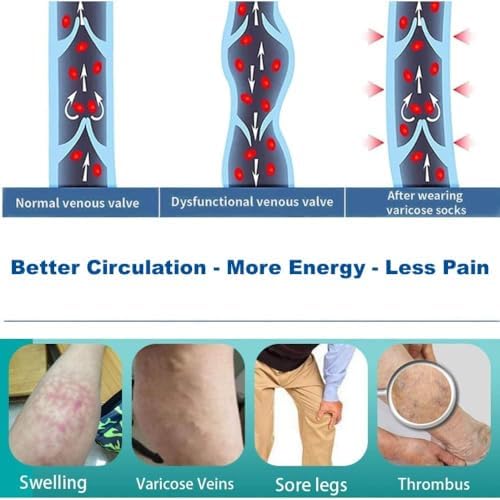 Anti Embolism Ted Hose Thigh High 20-30 mmHg Compression Stocking Toeless,Post Surgery Nurse Compression Socks Support for Women & Men