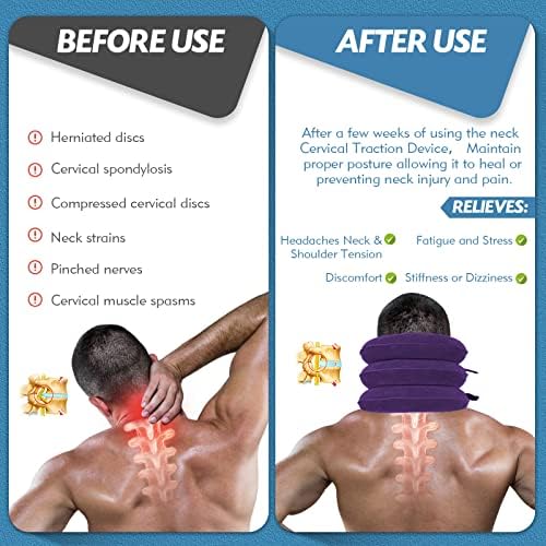 Neck Stretcher, Neck Traction Device, Cervical Traction Device, Neck Pain Relief, Adjustable Inflatable Neck Brace & Neck Stretcher Cervical Traction, Neck Decompression Home Use (Purple)