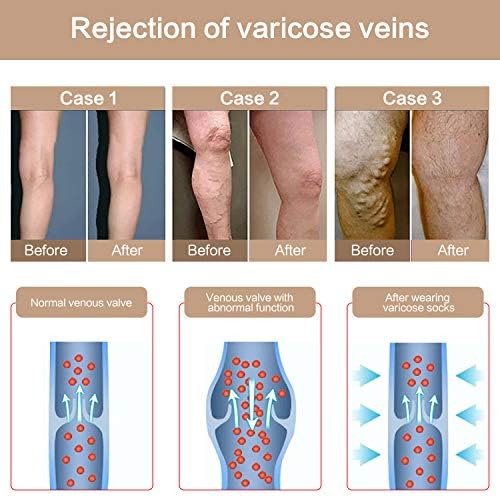 KISSLIFE 2 Pairs Compression Pantyhose Women Support Hose 20-30 mmHg Closed Toe Graduated Compression Stockings for Varicose Veins