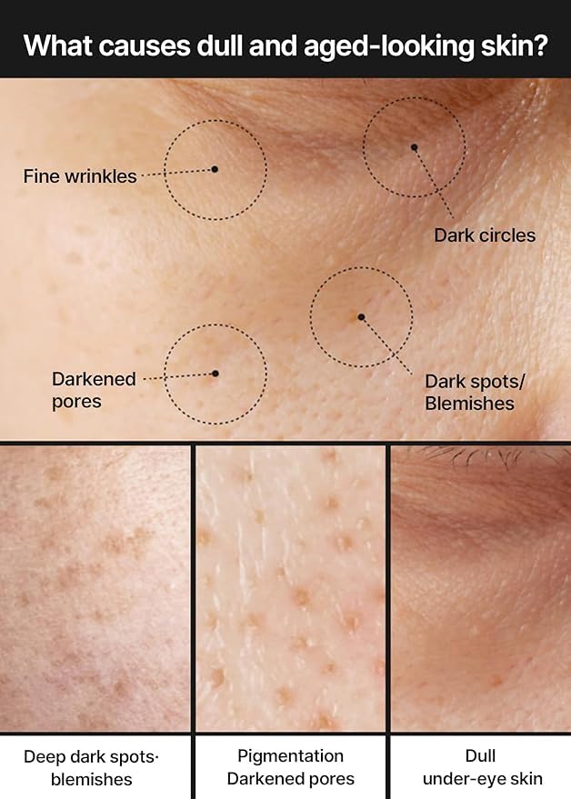 celimax Pore+Dark Spot Brightening Cream | with Niacinamide, Tranexamic Acid, TXA Cream, Pore Minimizer, Non-Irritating, Hydrating, For Sensitive Skin, 35ml, Mothers Day Gift