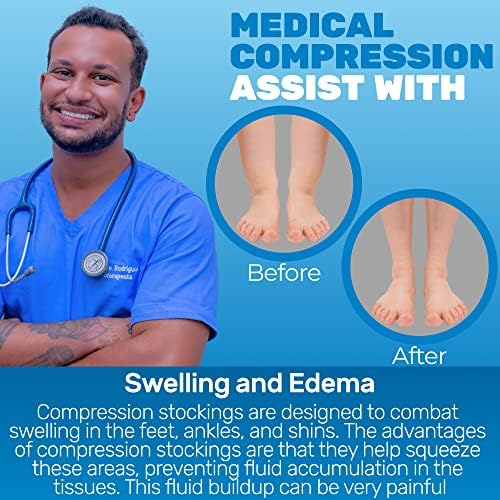 ABSOLUTE SUPPORT Compression Thigh High Stockings 20-30mmHg for Swelling, Silicone Border & Open Toe Socks for Women & Men, A213SW