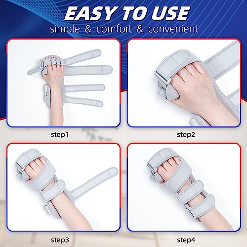Fanwer Resting Hand Splint - Hand Brace for Stroke Patients, for Straightening Fingers-for Carpel Tunnel, Stroke Recovery, Arthritis, Tendinitis