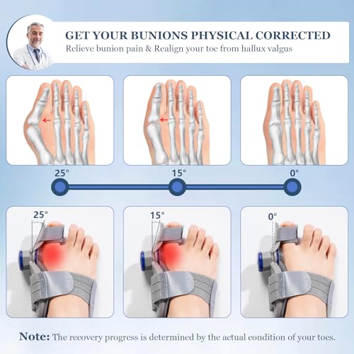 Bunion Corrector for Women & Men,Treatmedy Bunion Fix,Adjustable Toe Straightener - Orthopedic Bunion Splint for Big Toe Alignment, Hallux Valgus Correction, Left/Right Feet Relief (1PCS)