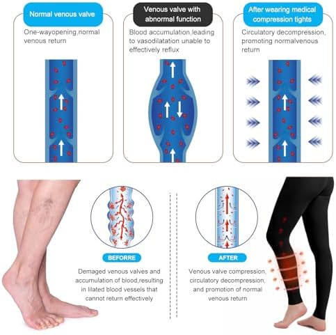 Medical Compression Pantyhose for Women & Men, 20-30mmHg Graduated Support Tights, Opaque Footless High Waist