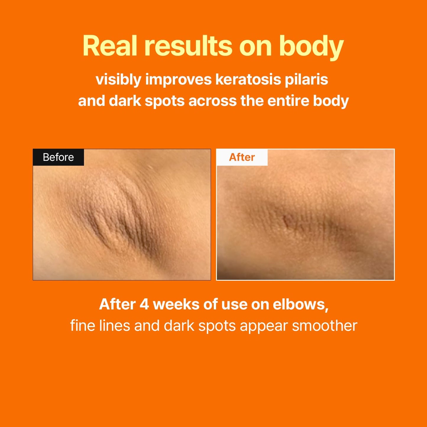 MEDITHERAPY Retinal Skin Booster Serum | Retinaldehyde, Niacinamide Anti-Aging Serum - K-Beauty Facial Serum for Fine Lines, Firming & Radiance | Hydrating Face Serum All Skin Types, 5.07 fl oz