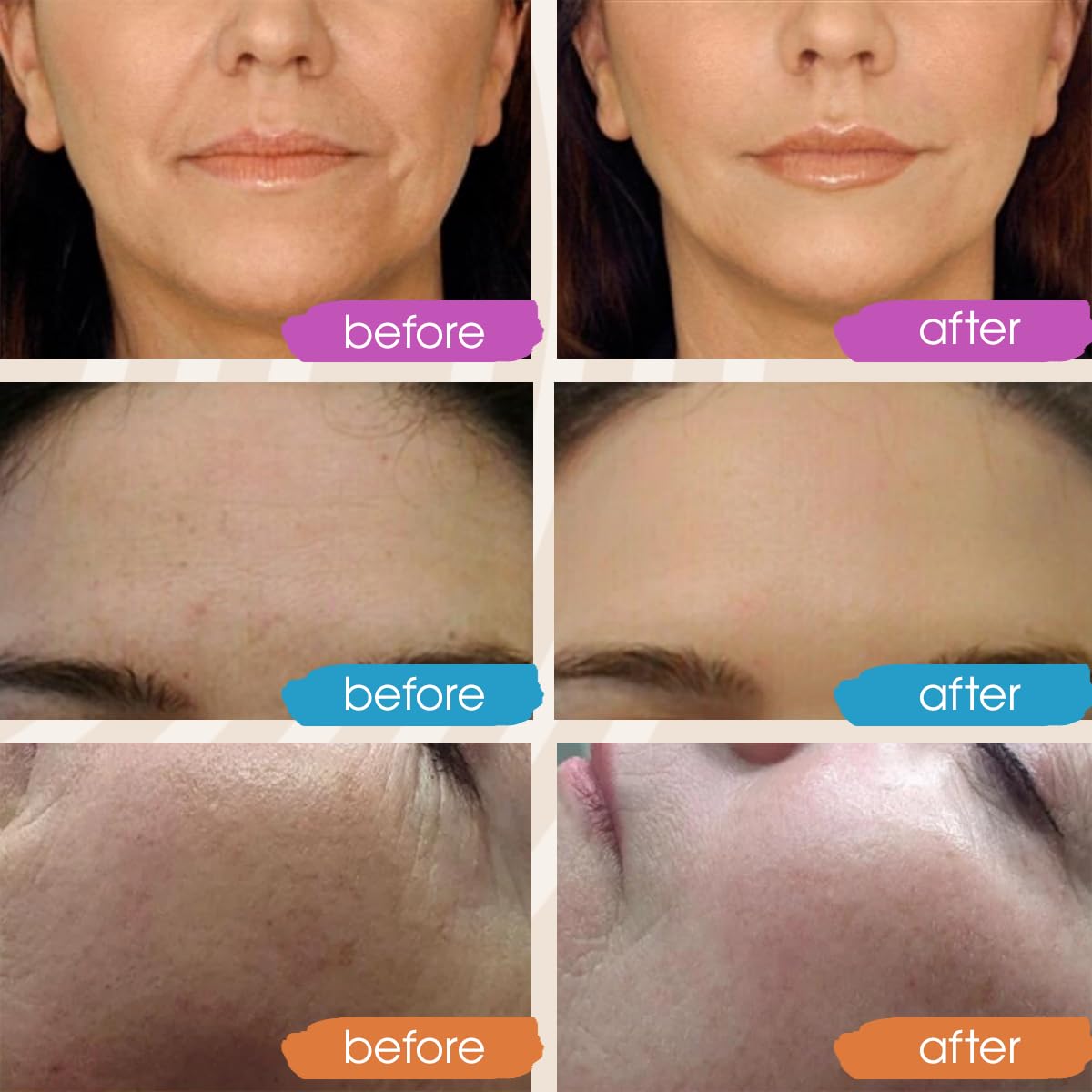 Retinol Serum for Face with Hyaluronic Acid, Retinol for Face Is Suitable for All Skin Types, Hydrating Serum Women and Men Plumps Youthful Appearance 2oz