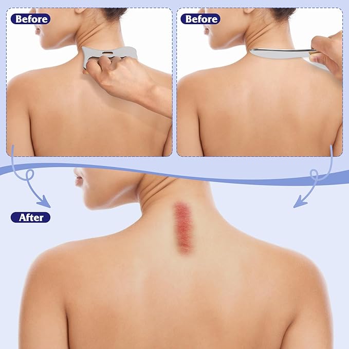 Guasha Massage Tool, Grade Stainless Steel Scraping Tool for Soft Tissue Upgrade Physical Therapy Stuff,Used for Back, Legs, Arms,Neck,Shoulder, Gua sha Tool…（S+Square Shaped）