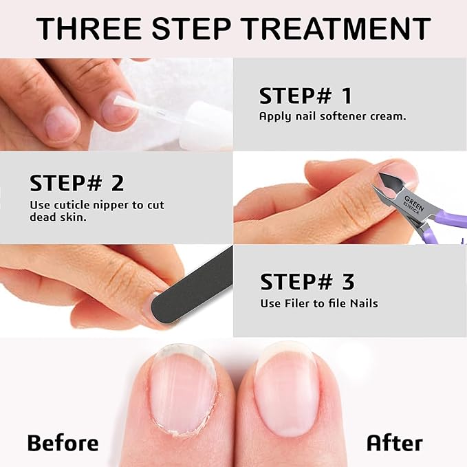 Professional Cuticle Trimmer Nail Cuticle Cutter Stainless Steel Cuticle Nippers with Sharp Blades of Cuticle Clippers Manicure Tools with Double Spring for Nail Care Pedicure Nail Tools (Purple)