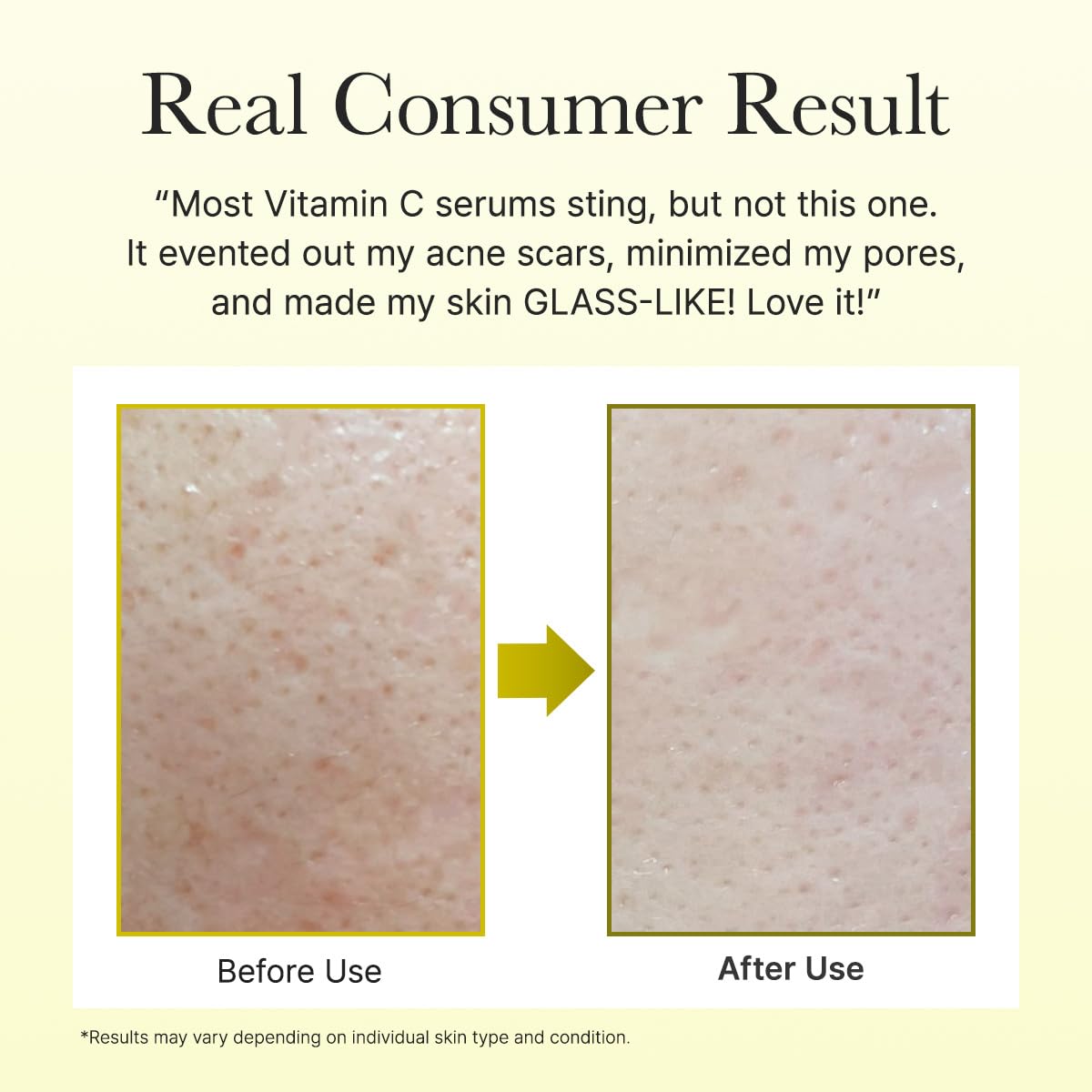 Arencia Vitamin C Booster Shot Serum with Glutathione, Niacinamide and Vitamin E for Dark Spot Care, Fine Lines & Wrinkles, Glass Skin, Korean Skincare 30ml/1.01 fl.oz