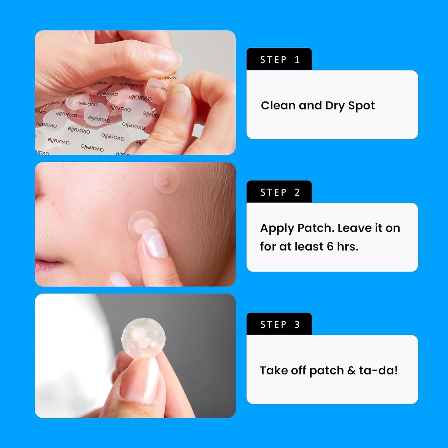 AVARELLE Pimple Patches for Face | Hydrocolloid Acne Patches for Covering Blemishes | Zit Patches with Tea Tree, Calendula, & Cica | HSA Store Eligible Items (10-14 mm, 200, Count)