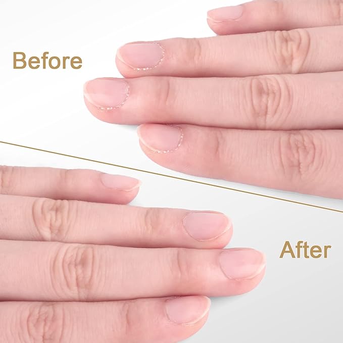 Cuticle Trimmer with Cuticle Pusher - Easkep Cuticle Remover Cuticle Nipper Professional Stainless Steel Cuticle Cutter Clipper Pedicure Manicure Tools for Fingernails and Toenails (D501-Silver)