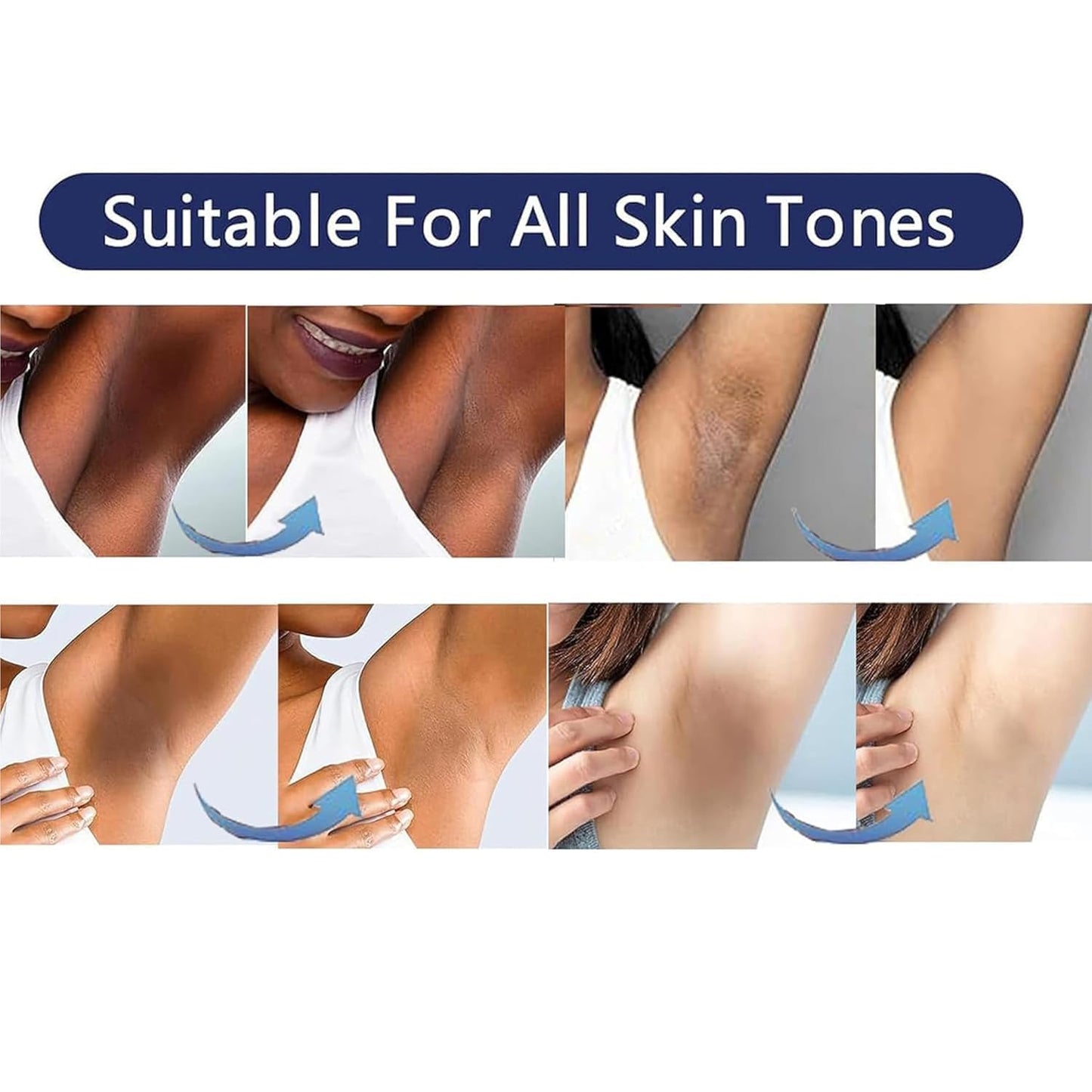 Skin Bleaching Cream Skin Lightening for Body Intimate Areas, Private Parts, Underarm, Knees, Elbows, Inner Thigh, Bikini Area, Whitening Cream Dark Spot Remover For Intimate Areas (1.7FL OZ)
