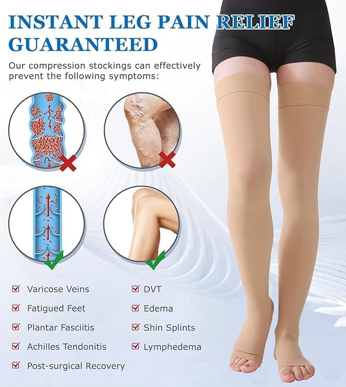 MGANG Medical Thigh High Compression Stockings for Men & Women, Pair, Open Toe, 20-30 mmHg Graduated Compression Support Hose, Opaque, Best for Varicose Veins, Edema, Flight, DVT, Swelling, Beige XXL