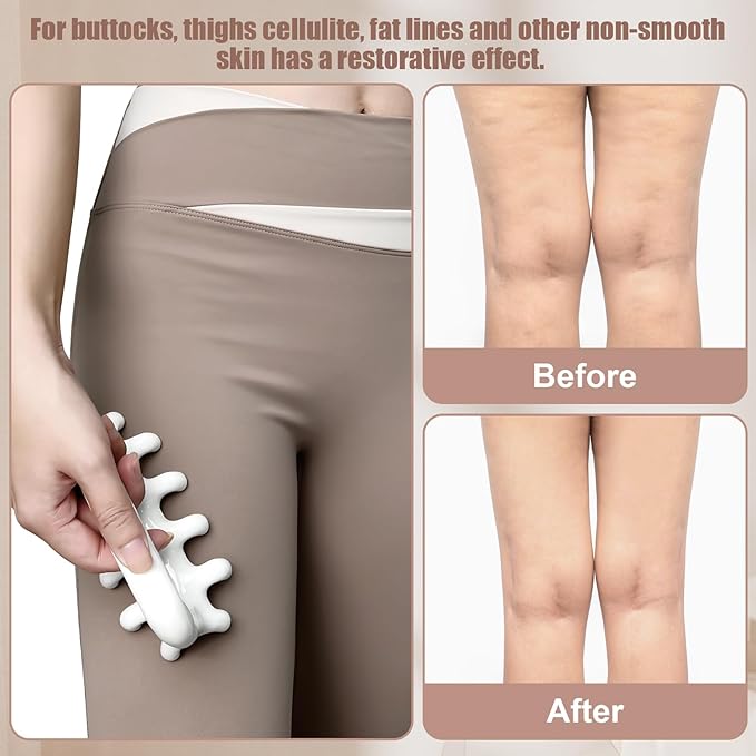 Fascia Massage Tool Trigger Point Massage Tools Anti Blaster for Cellulite Massage Tool Reaching Deep Myofascial Tissue Throughout The Body Release Muscle Knot Reduction Cellulite